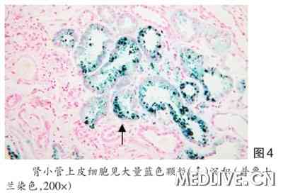 粒细胞集落刺激因子在急性心肌梗死治疗中的作用