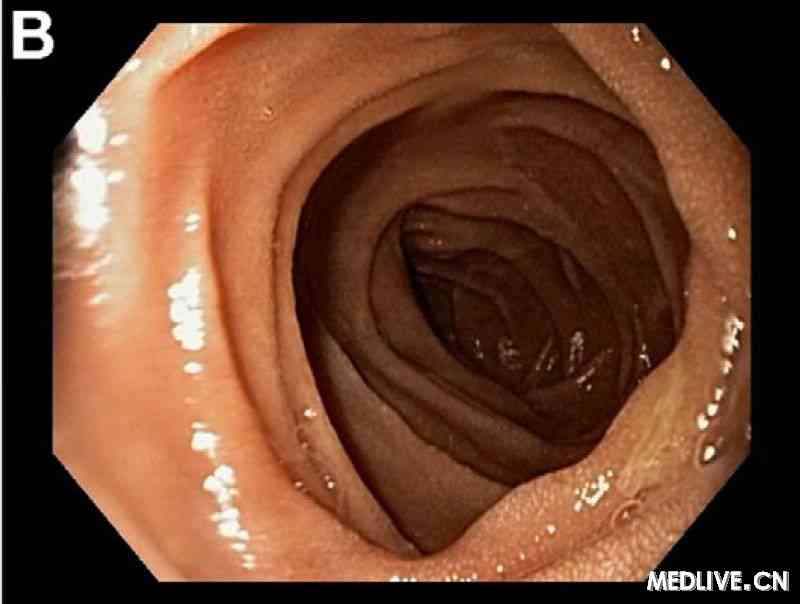 经典病例_【答案公布】<em>诊断</em>挑战:青年<em>女性</em>的水