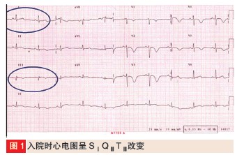 实时三平面超声心动图评价心肌梗死患者左心室总体收缩功能的研究