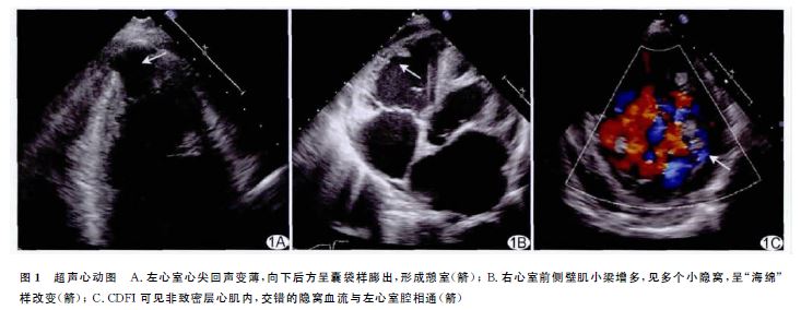 检查时患儿要处于安静状态,哭闹的患儿检查前予以6%水合氯醛口服或