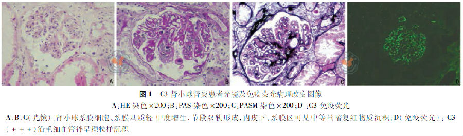 c3肾小球肾炎一例