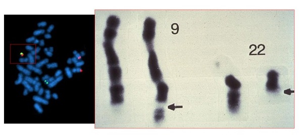 经典病例_【答案公布-1】经典血液学诊断(一)