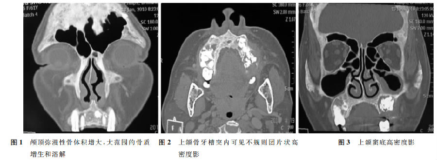 圖片信息