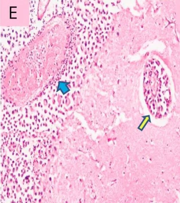 蓝色血管 15210920025553.jpg