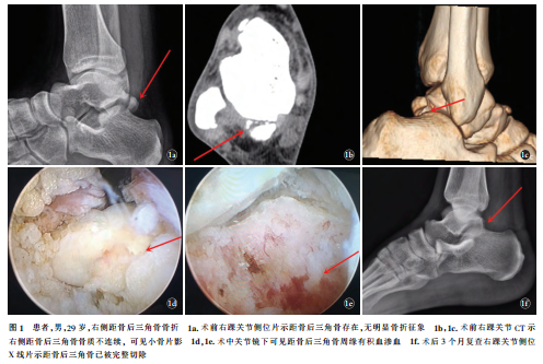 成语积什么消骨_成语故事图片(3)