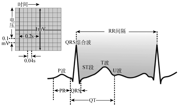 心电图评估5步法——频率,节律,心电轴,间期和损伤