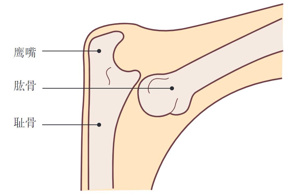 图137.11 肘关节脱位:简单的后脱位