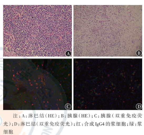 患者淋巴结,胰腺组织病理学改变(×200)