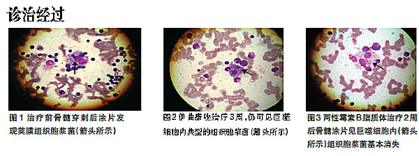 1例诊治过程曲折的播散型组织胞浆菌病