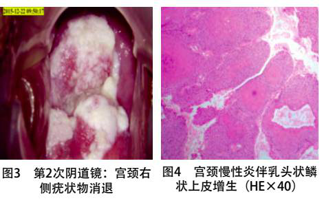 白塞病症状生殖图片图片