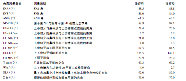 正畸头影测量标志点图片