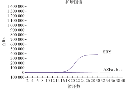 一例SRY阳性46,XX男性性反转综合征病例